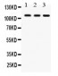 Anti-CYLD Picoband Antibody